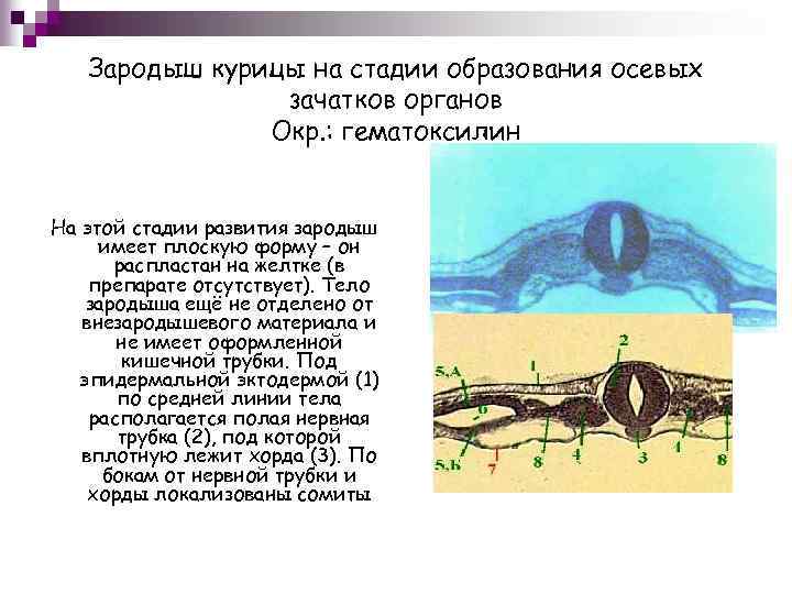 Стадии зародыша курицы. Зародыш курицы на стадии осевых зачатков. Зародыш курицы на стадии образования осевых зачатков. Зародыш курицы на стадии образования осевых органов препарат. Зародыш курицы на стадии закладки осевых органов.