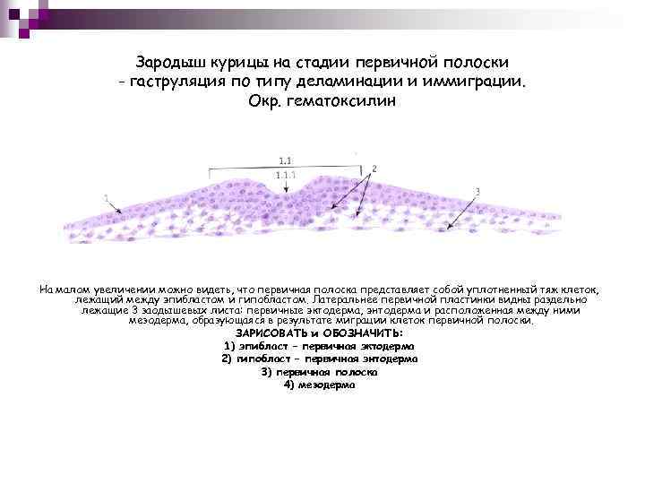 Первичная полоска зародыша