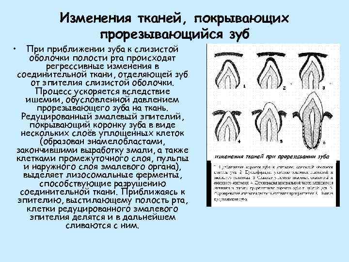 Как меняется изображение прорези на колпачке лампы при приближении предмета к линзе