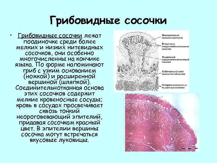 Грибовидные сосочки • Грибовидные сосочки лежат поодиночке среди более мелких и низких нитевидных сосочков,