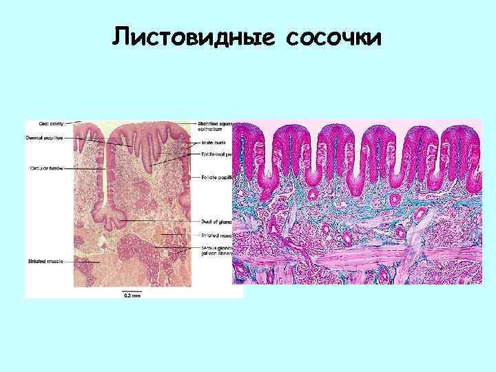 Листовидные сосочки 