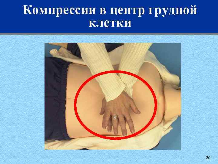 Компрессии в центр грудной клетки 20 