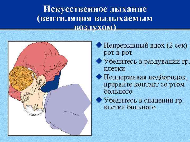 Искусственное дыхание (вентиляция выдыхаемым воздухом) u Непрерывный вдох (2 сек) рот в рот u
