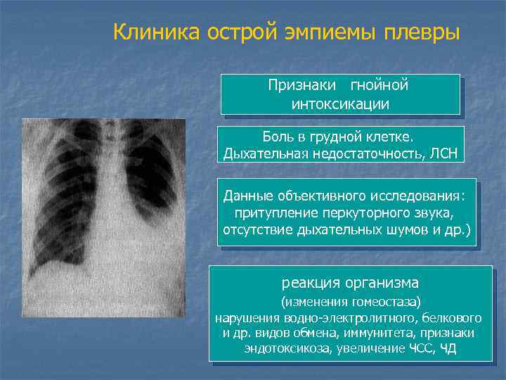 Клиника острой эмпиемы плевры Признаки гнойной интоксикации Боль в грудной клетке. Дыхательная недостаточность, ЛСН