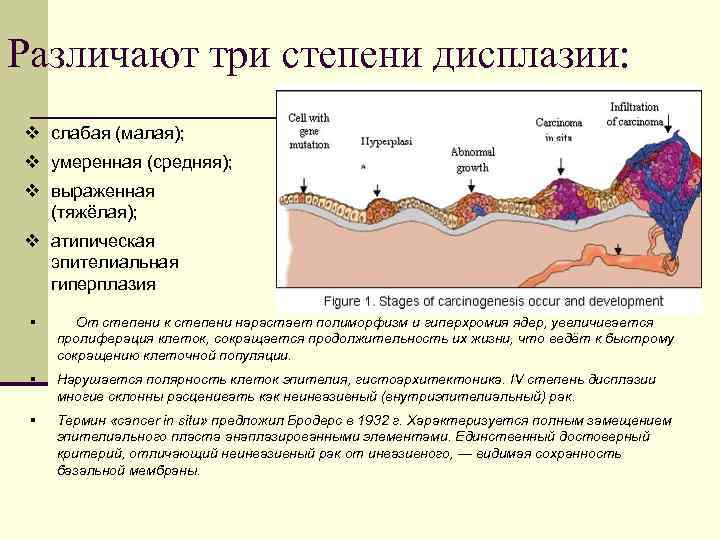 Различают три степени дисплазии: v слабая (малая); v умеренная (средняя); v выраженная (тяжёлая); v