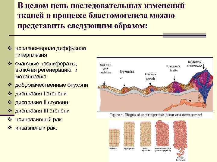 В целом цепь последовательных изменений тканей в процессе бластомогенеза можно представить следующим образом: v