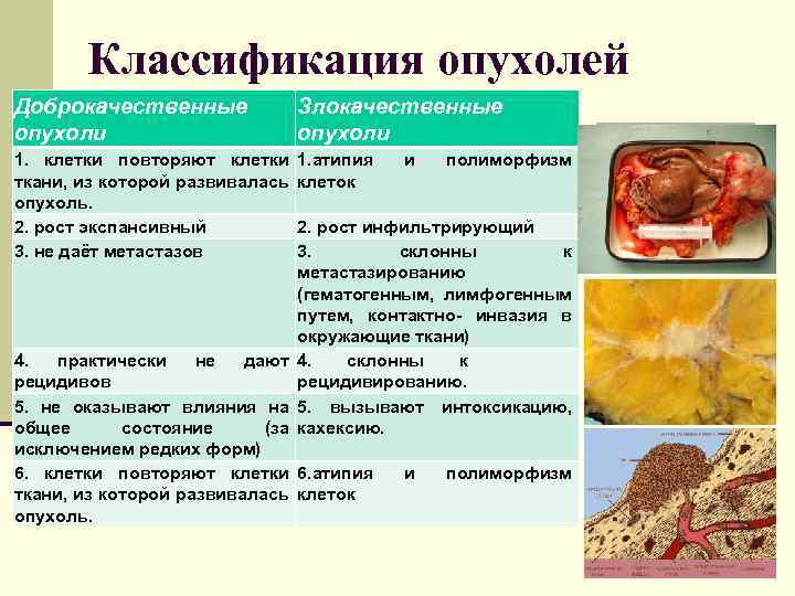 Классификация опухолей Доброкачественные опухоли Злокачественные опухоли 1. клетки повторяют клетки 1. атипия и полиморфизм