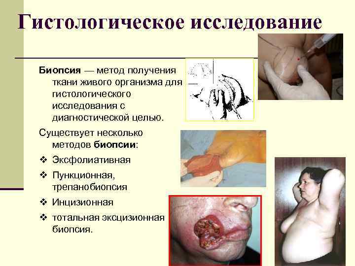 Гистологическое исследование Биопсия — метод получения ткани живого организма для гистологического исследования с диагностической