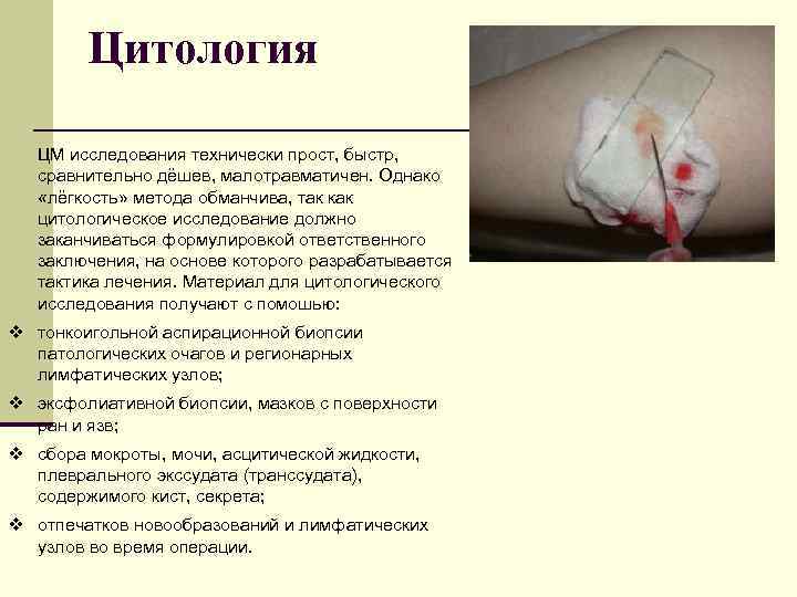 Цитология ЦМ исследования технически прост, быстр, сравнительно дёшев, малотравматичен. Однако «лёгкость» метода обманчива, так