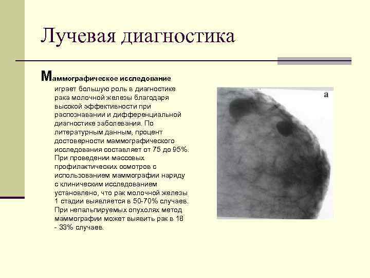 Лучевая диагностика Маммографическое исследование играет большую роль в диагностике рака молочной железы благодаря высокой