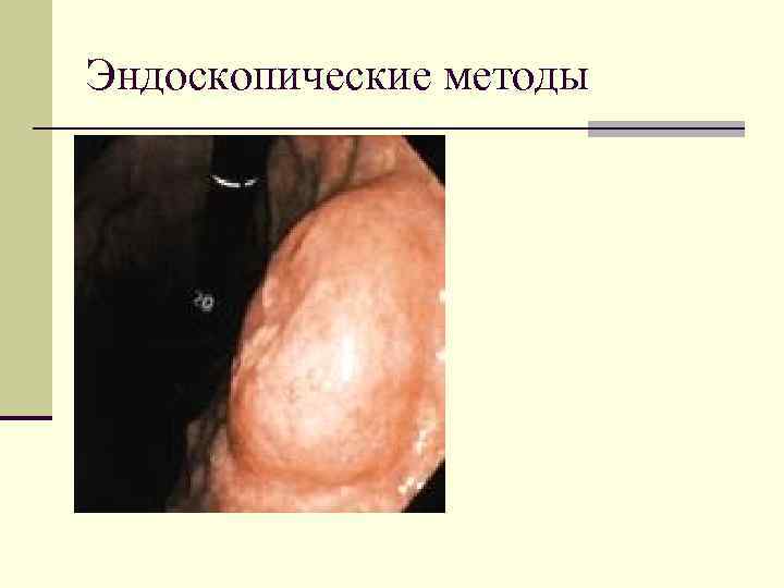 Эндоскопические методы 