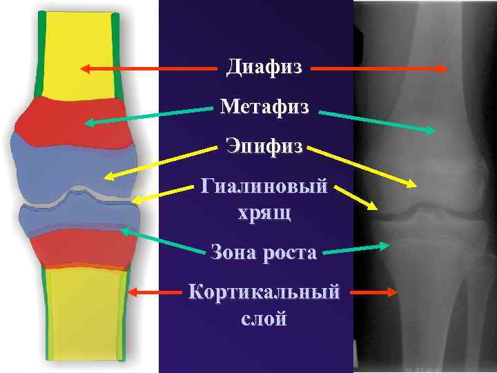 Диафиз кости. Диафиз эпифиз Апофиз. Эпифиз диафиз метафиз. Строение костей метафиз. Хрящ зона роста.