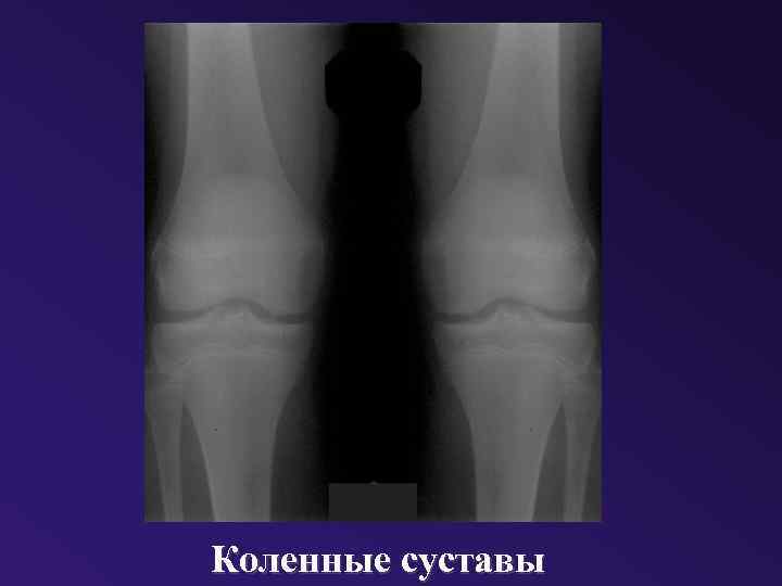 Коленные суставы 