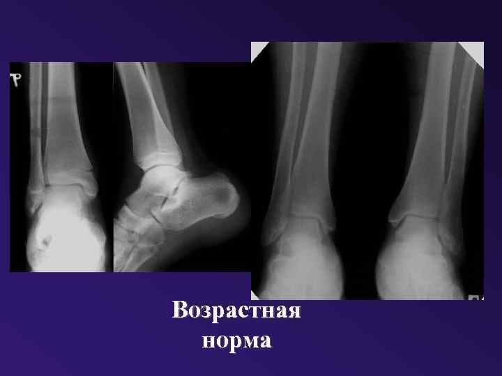 Возрастная норма 