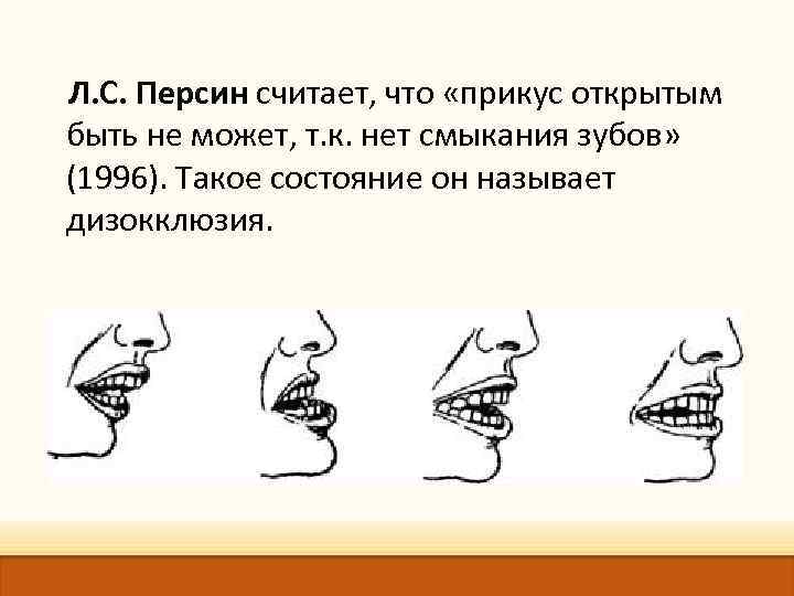 Л. С. Персин считает, что «прикус открытым быть не может, т. к. нет