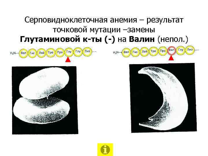 Серповидноклеточная анемия – результат точковой мутации –замены Глутаминовой к-ты (-) на Валин (непол. )
