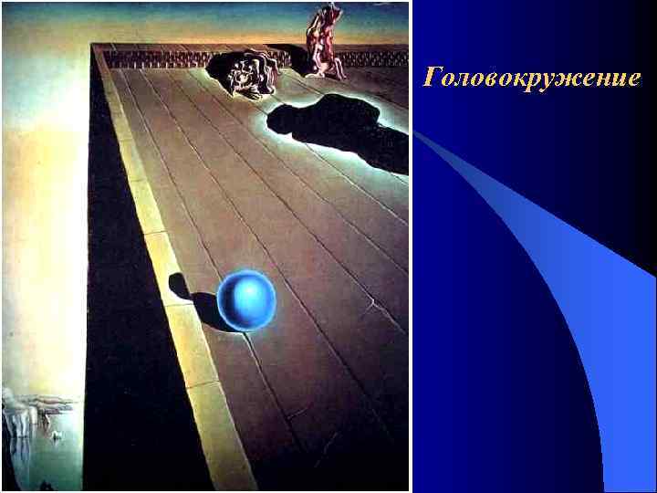 Головокружение 