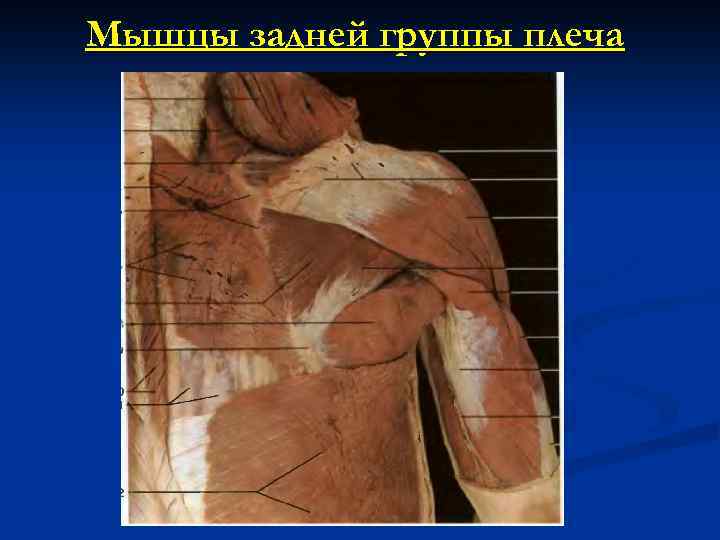 Мышцы задней группы плеча 