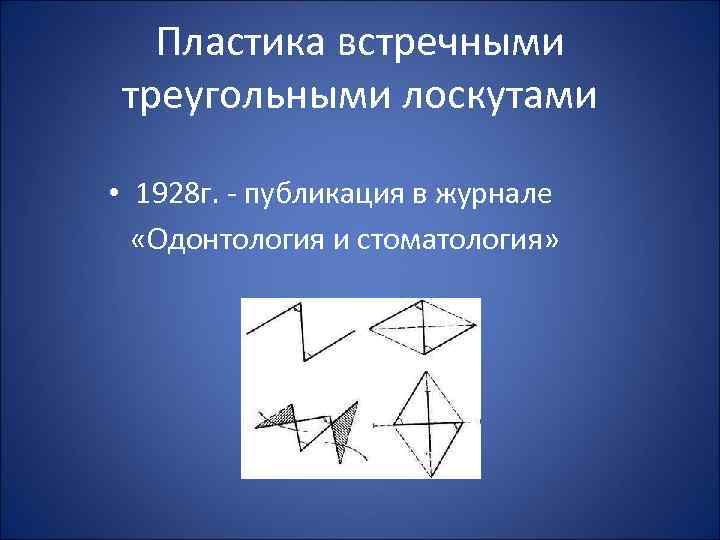Пластика встречными треугольными лоскутами • 1928 г. - публикация в журнале «Одонтология и стоматология»