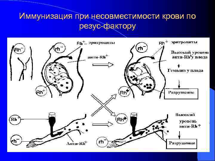 Иммунизация при несовместимости крови по резус-фактору Иммунизация при несовместимости крови по резус-фактору