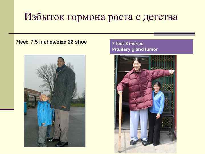 Избыток гормона роста с детства 7 feet 7. 5 inches/size 26 shoe 7 feet