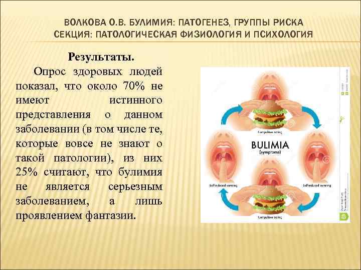 ВОЛКОВА О. В. БУЛИМИЯ: ПАТОГЕНЕЗ, ГРУППЫ РИСКА СЕКЦИЯ: ПАТОЛОГИЧЕСКАЯ ФИЗИОЛОГИЯ И ПСИХОЛОГИЯ Результаты. Опрос