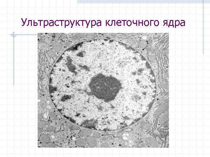 Ультраструктура клеточного ядра 