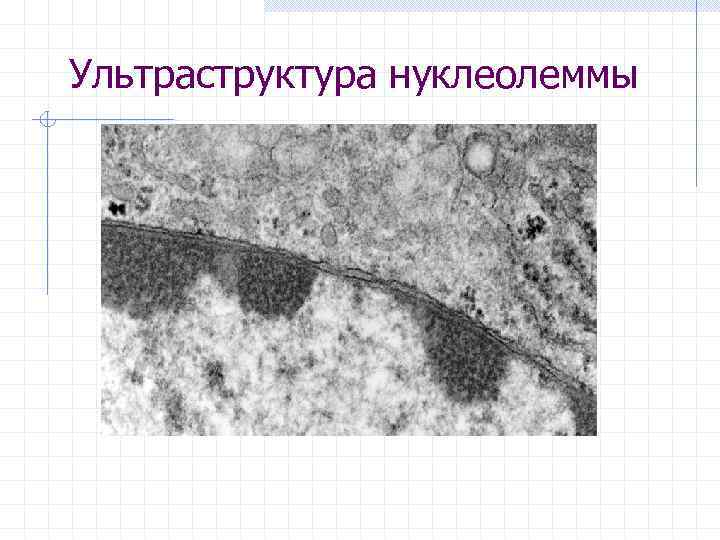Ультраструктура нуклеолеммы 