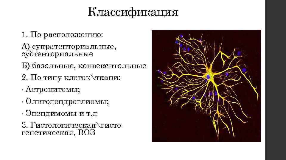 Классификация 1. По расположению: А) супратенториальные, субтенториальные Б) базальные, конвекситальные 2. По типу клетокткани: