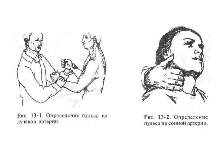 Измерение пульса алгоритм. Определение пульса на лучевой артерии. Техника измерения пульса на лучевой артерии. Определение пульса на лучевой и на сонной артериях. Техника определения пульса на сонной артерии.