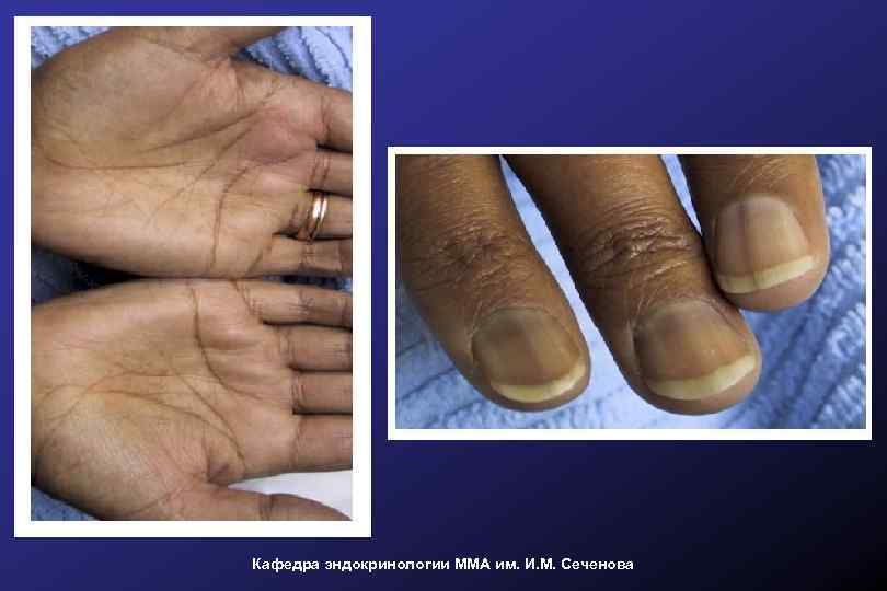 Кафедра эндокринологии ММА им. И. М. Сеченова 