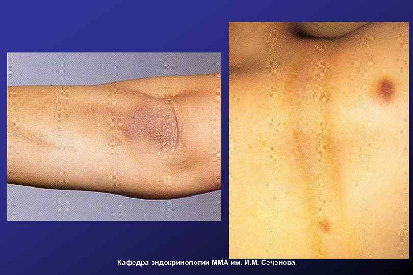 Кафедра эндокринологии ММА им. И. М. Сеченова 