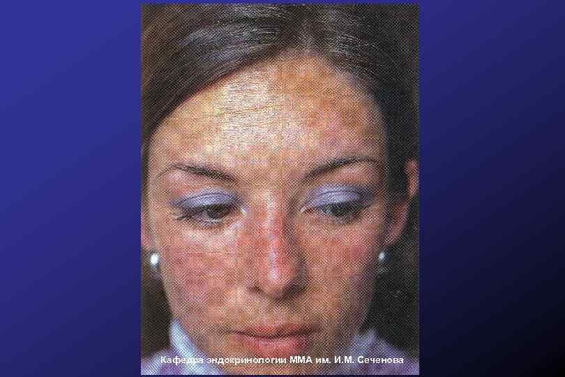 Кафедра эндокринологии ММА им. И. М. Сеченова 