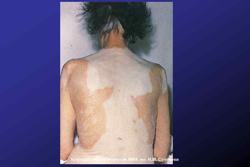 Кафедра эндокринологии ММА им. И. М. Сеченова 