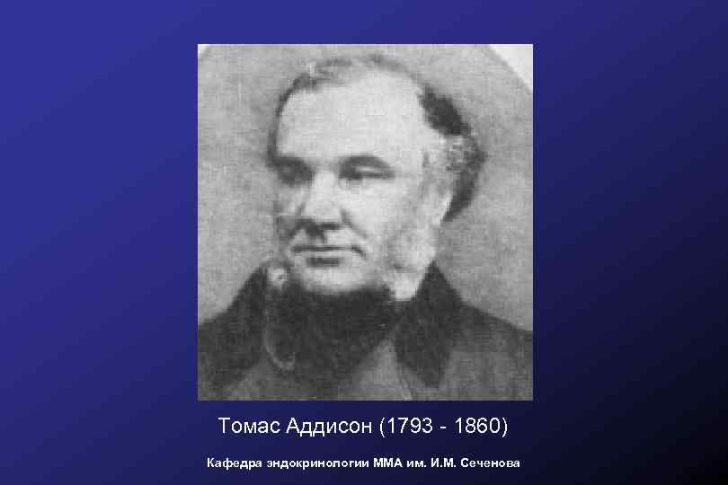Томас Аддисон (1793 - 1860) Кафедра эндокринологии ММА им. И. М. Сеченова 