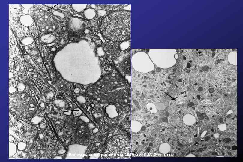 Кафедра эндокринологии ММА им. И. М. Сеченова 