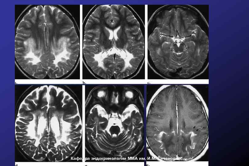 Кафедра эндокринологии ММА им. И. М. Сеченова 