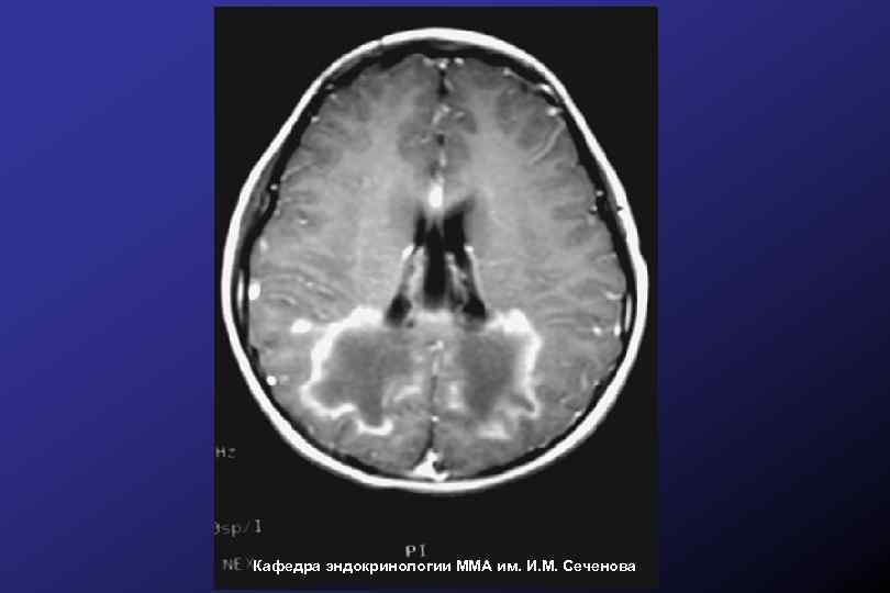 Кафедра эндокринологии ММА им. И. М. Сеченова 