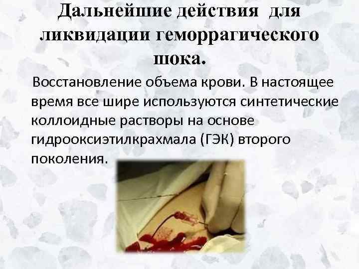 Дальнейшие действия для ликвидации геморрагического шока. Восстановление объема крови. В настоящее время все шире