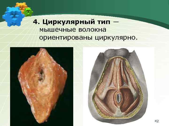 4. Циркулярный тип ― мышечные волокна ориентированы циркулярно. 42 