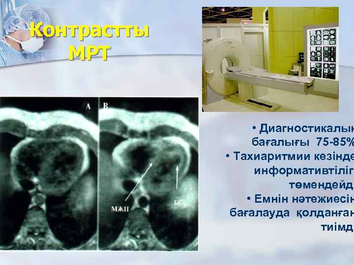 Контрастты МРТ • Диагностикалық бағалығы 75 -85% • Тахиаритмии кезінде информативтілігі төмендейді • Емнін