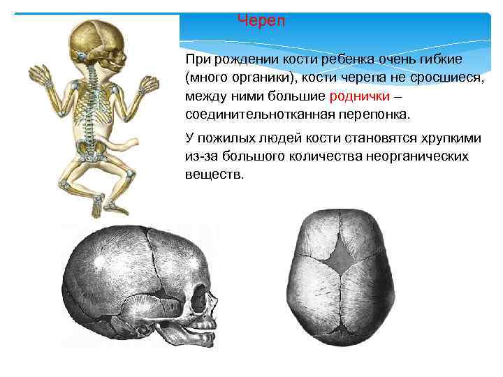 Много ли костей. Сросшиеся кости черепа у ребенка. Кости ребенка при рождении.