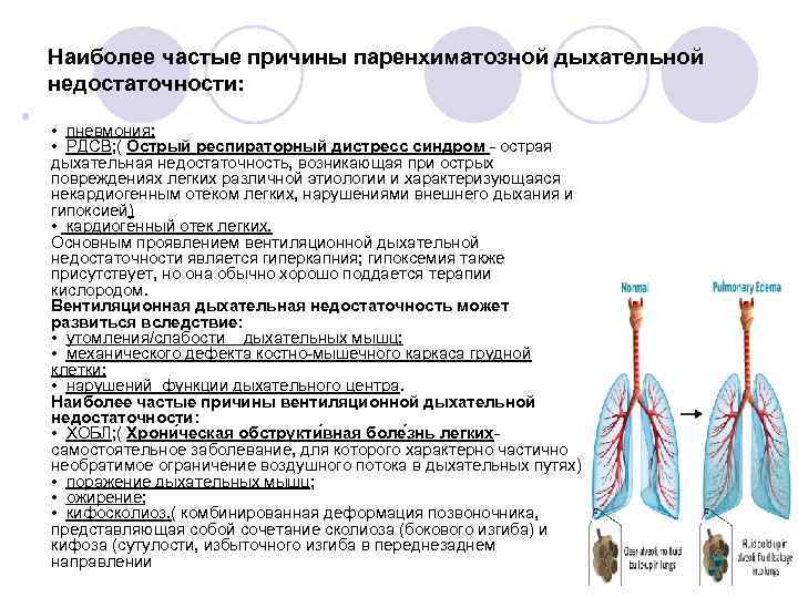 Обусловлено дыхательной недостаточностью. Патогенез дыхательной недостаточности. Паренхиматозная дыхательная недостаточность. Причины развития заболеваний органов дыхания.