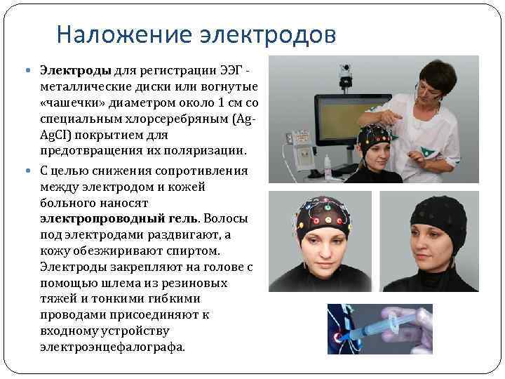 Наложение электродов Электроды для регистрации ЭЭГ ‑ металлические диски или вогнутые «чашечки» диаметром около