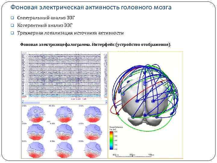 Фоновая электрическая активность головного мозга q Спектральный анализ ЭЭГ q Когерентный анализ ЭЭГ q