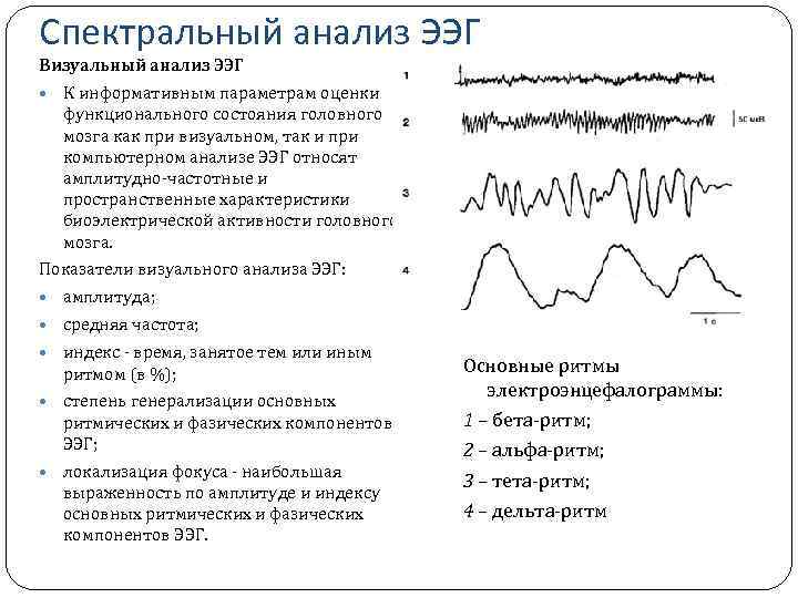 Спектральный анализ ЭЭГ Визуальный анализ ЭЭГ К информативным параметрам оценки функционального состояния головного мозга