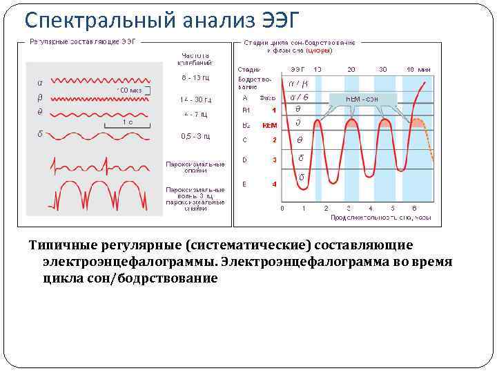 Спектральный анализ ЭЭГ Типичные регулярные (систематические) составляющие электроэнцефалограммы. Электроэнцефалограмма во время цикла сон/бодрствование 