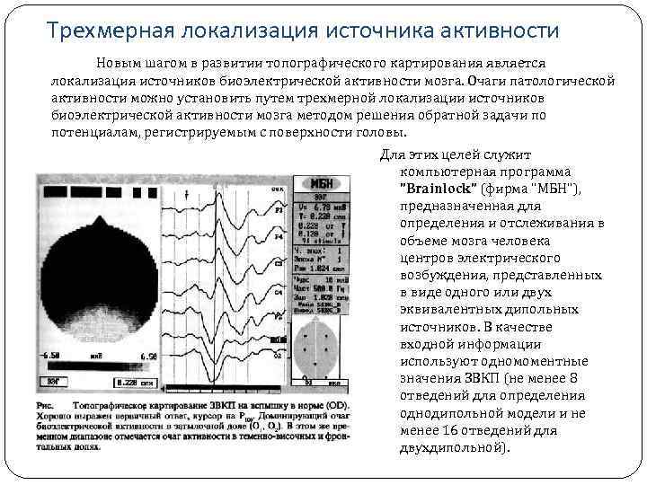 Трехмерная локализация источника активности Новым шагом в развитии топографического картирования является локализация источников биоэлектрической