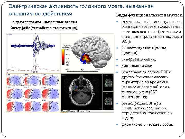 Электрическая активность головного мозга, вызванная внешним воздействием Виды функциональных нагрузок: Энцефалограмма. Вызванные ответы. Интерфейс