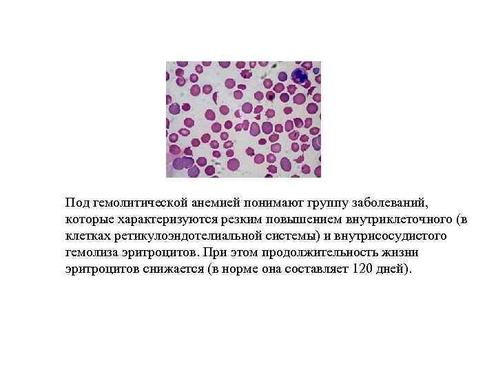 Гемолитическая анемия картина крови